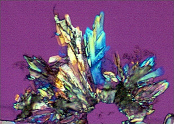 A crystal of the anti-AIDS drug zidovudine (AZT), viewed under polarized light.