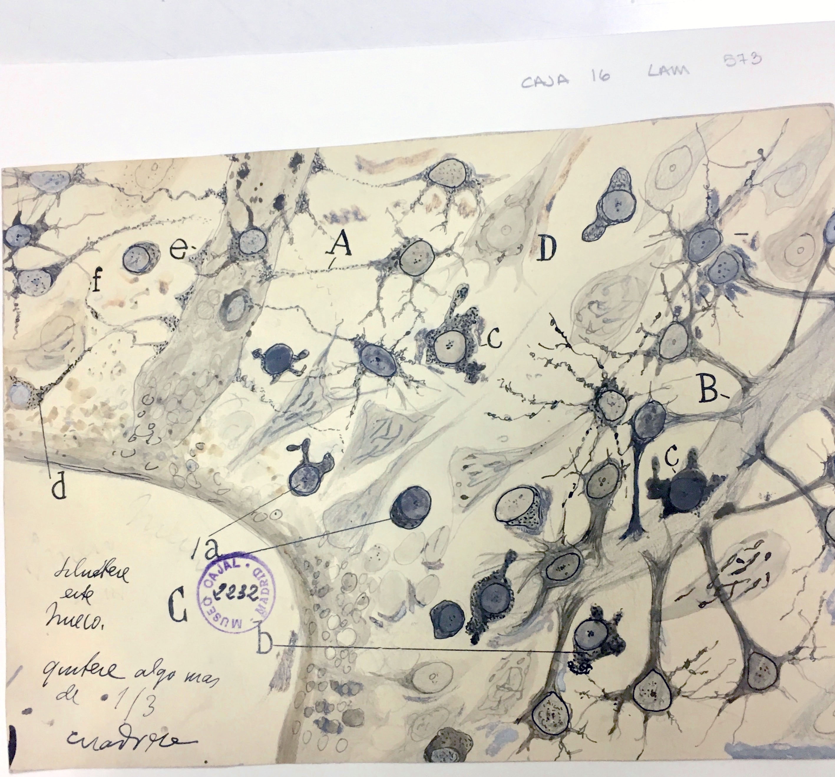 Hand-drawn illustration of astrocytes at the border of a wound