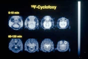 Images showing the effect of cyclofoxy on a baboon brain