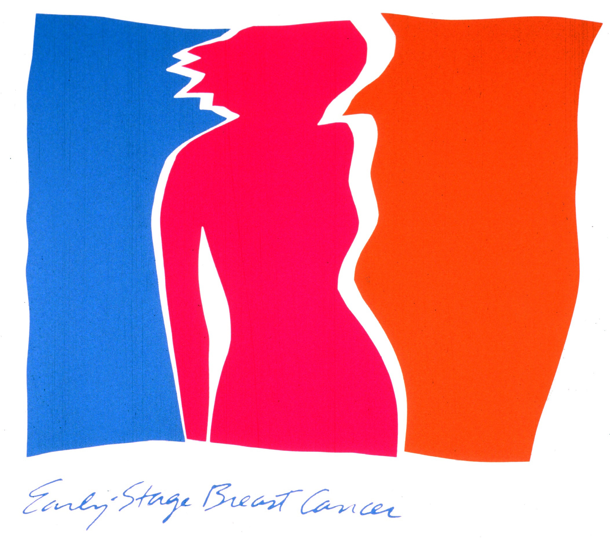 Early Stage Breast Cancer Poster