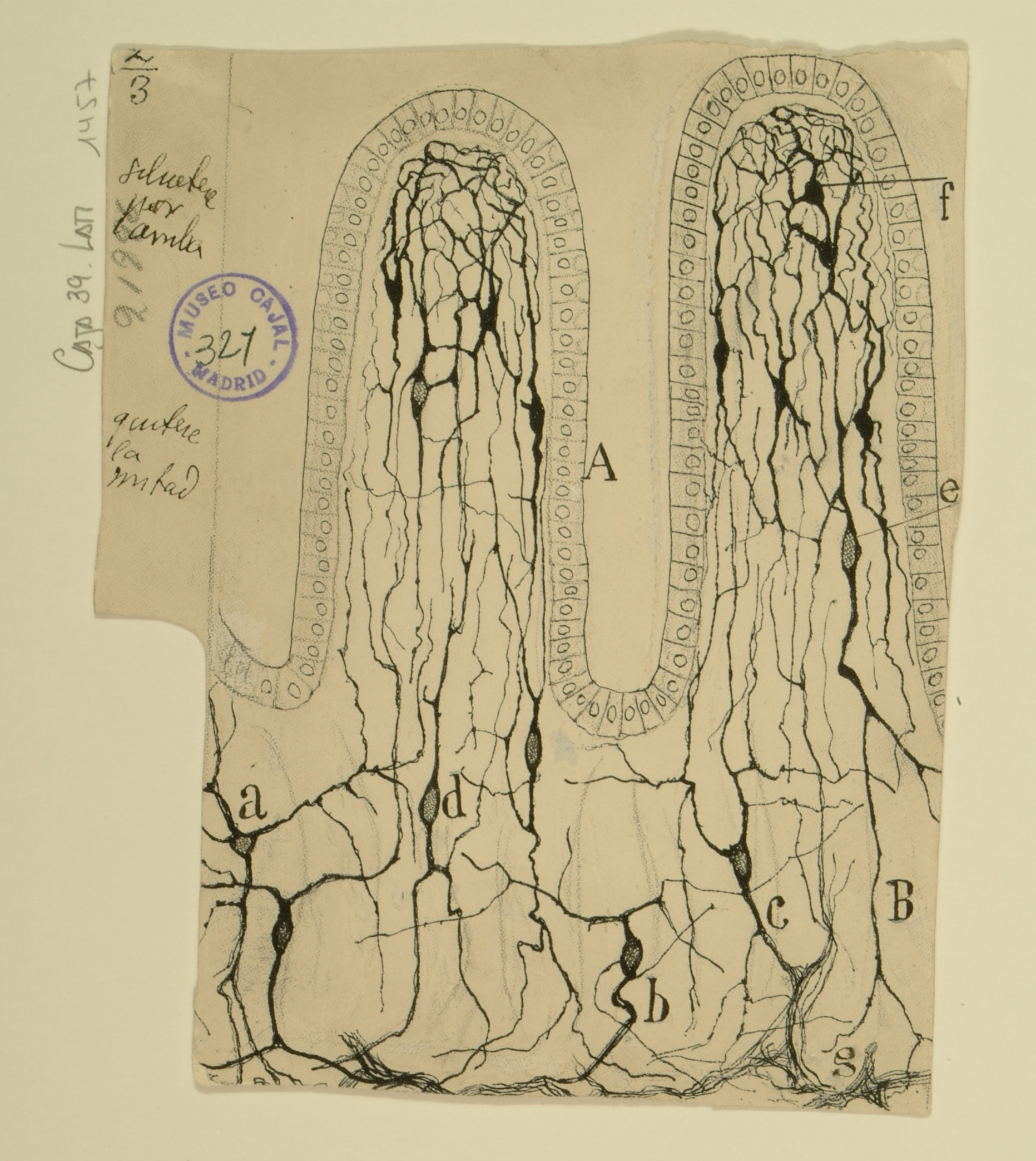 Hand-drawn illustration of intestinal villi