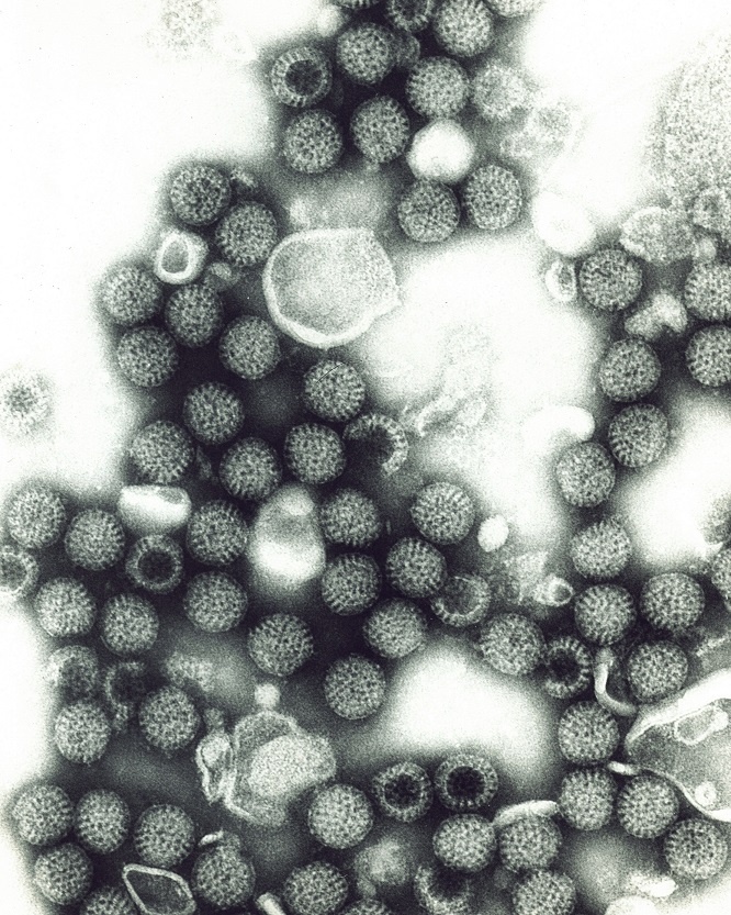 Rotavirus electron microscope image.