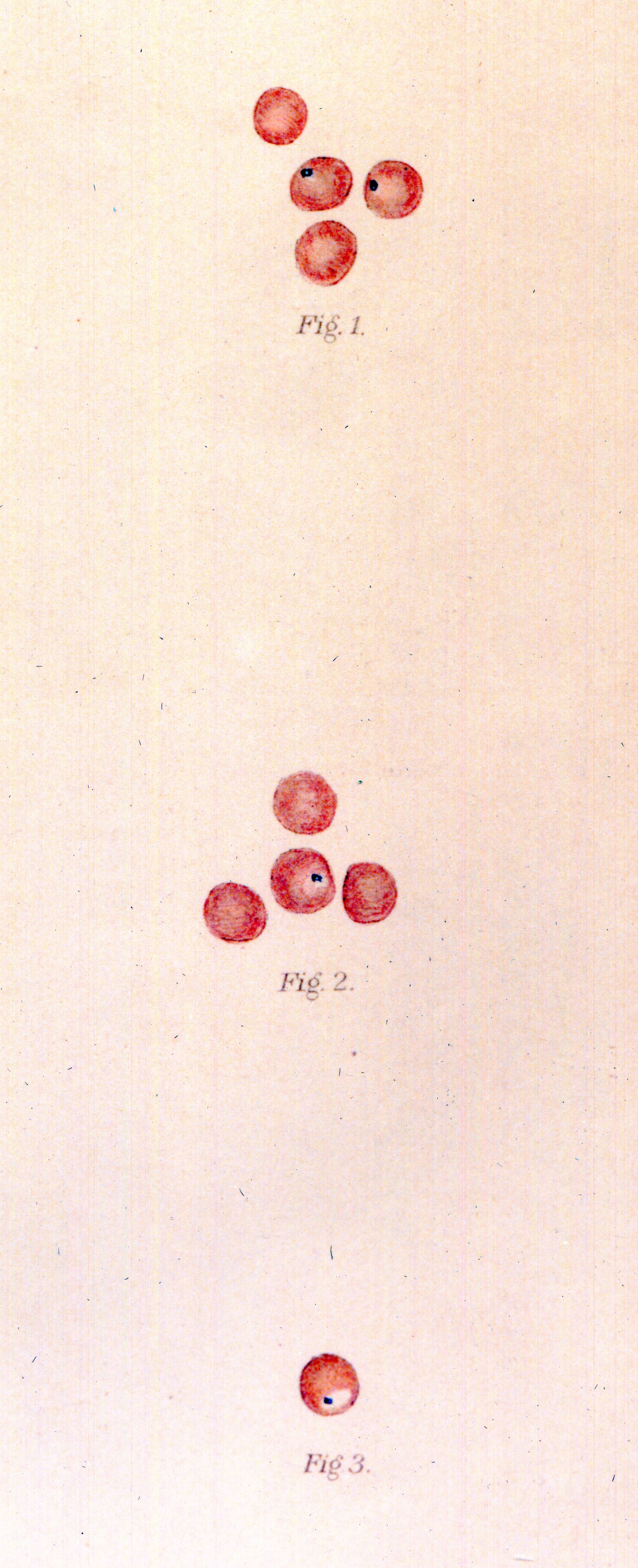 Three sets of drawings of red cells, some with black dots on them.