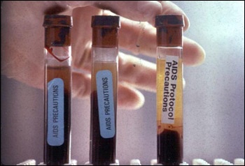 Photograph of testtubes containing potentially infected blood.