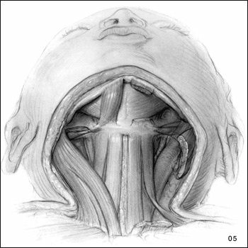 Hand-drawn illustration of Sequential Dissections of the Head from the Side