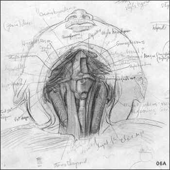 Hand-drawn illustration of Sequential Dissections of the Head from the Side