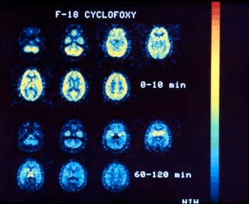 Additional images showing the effect of cyclofoxy on a baboon brain