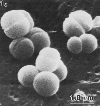 scanning electron micrograph of Methanospaera stadtmaniae, round spheres that almost appear cleaved in half