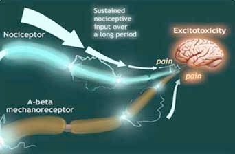 An illustration showing a nociceptor and an A-beta mechanoreceptor moving toward the feelings of pain and touch in the normal brain.